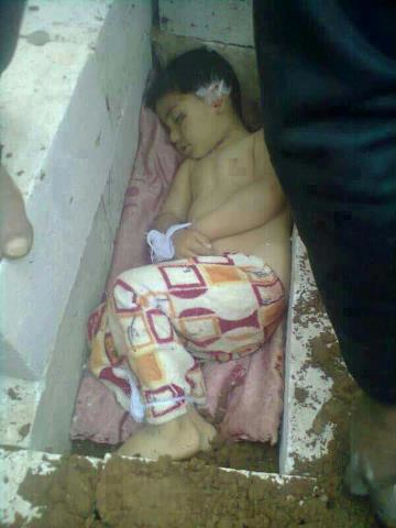 Anak-anak Paling Menderita di Dunia