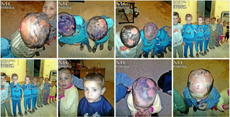Anak-anak Paling Menderita di Dunia