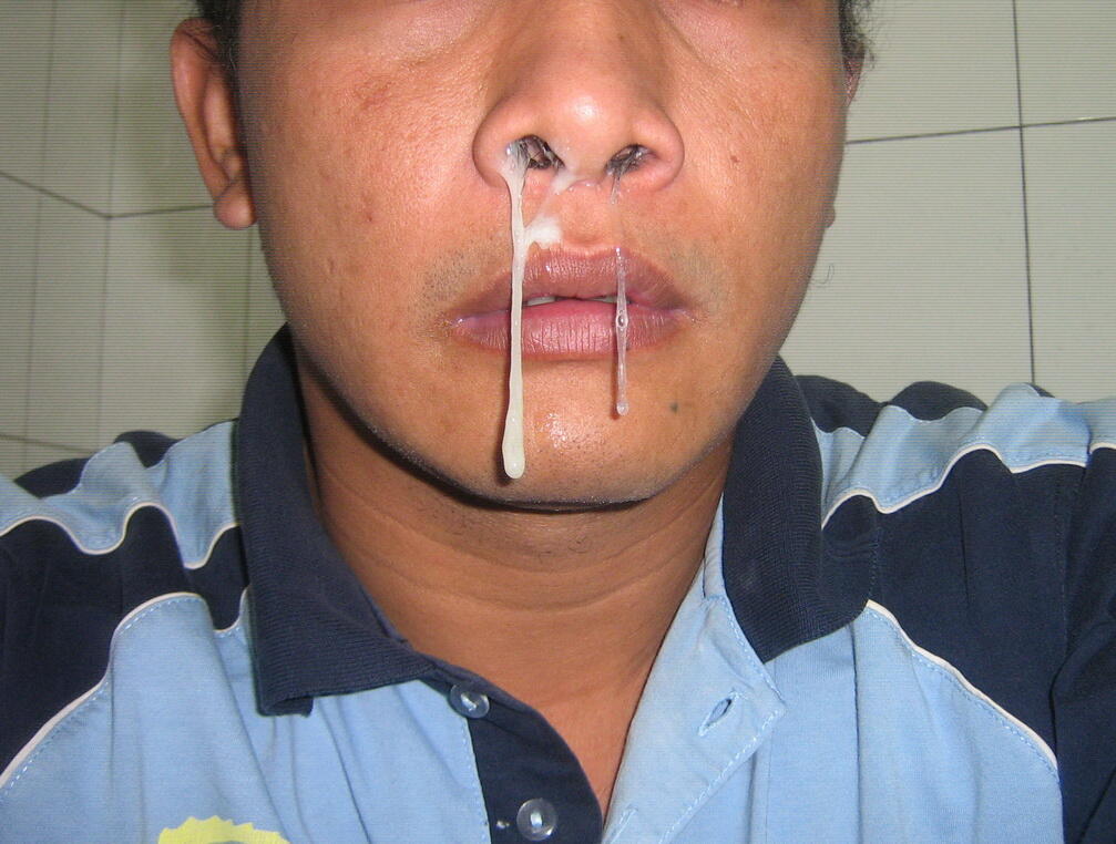 Mengetahui Jenis &quot;Cairan Hidung&quot;