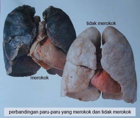 ROKOK ITU...