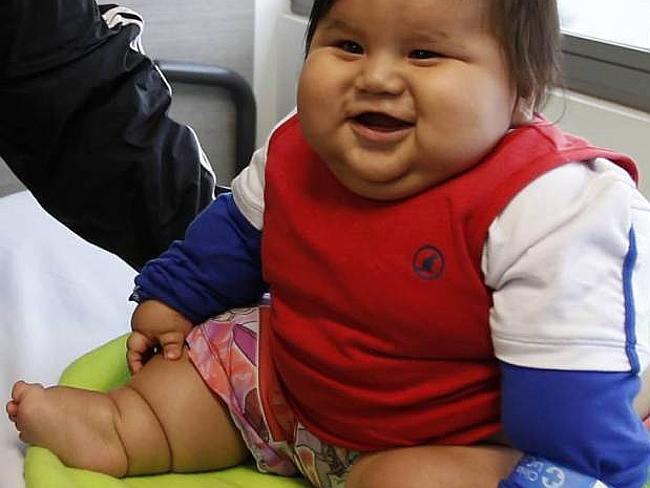 Santiago Mendoza, Balita Terbesar Asal Columbia beratnya 19 KG