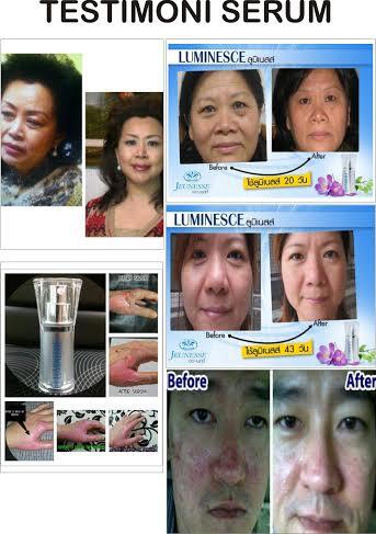 PRODUK KECANTIKAN JEUNESSE