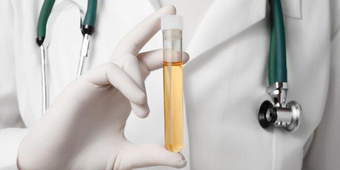 8 Fakta menarik tentang urine