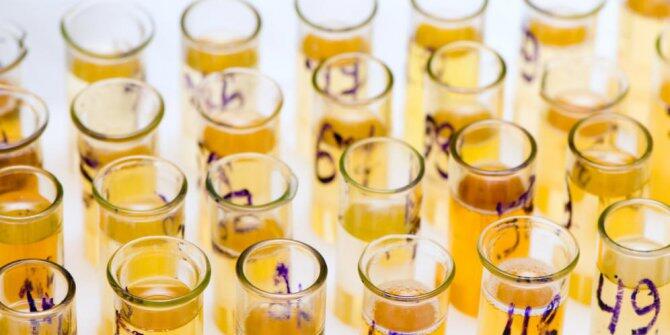 8 Fakta menarik tentang urine