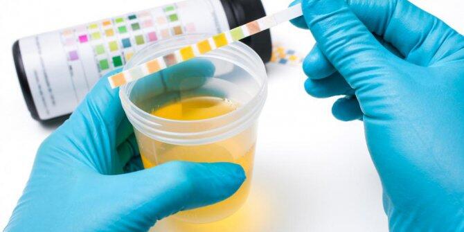 8 Fakta menarik tentang urine