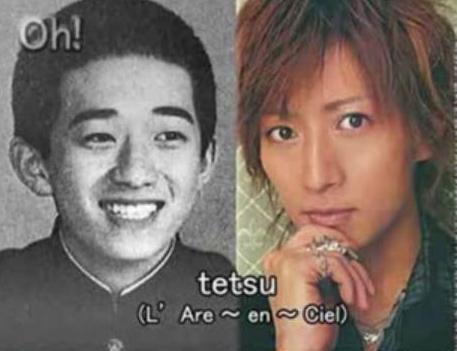 Wajah Tetsu Bassist Larc en Ciel Sebelum Operasi