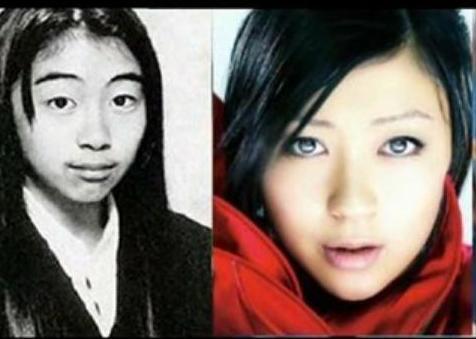 Wajah Tetsu Bassist Larc en Ciel Sebelum Operasi