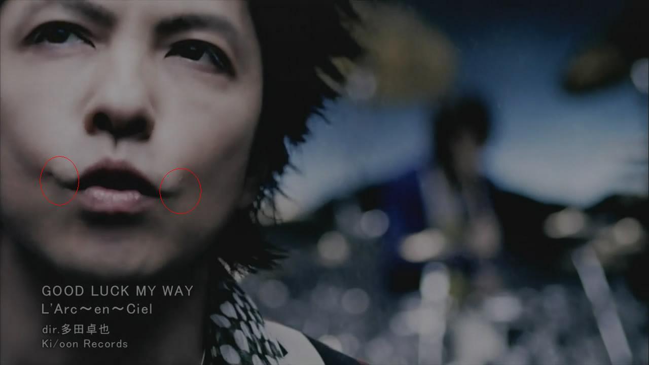 Wajah Tetsu Bassist Larc en Ciel Sebelum Operasi