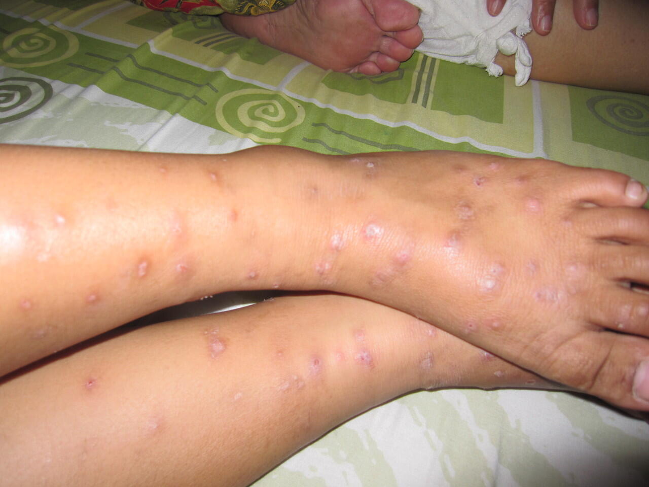 Jenis-Jenis Kutu (+Pict)