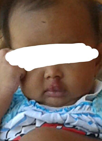 HELP. Pak Dokter Bu Dokter masuk bantu keponakan Ane :(