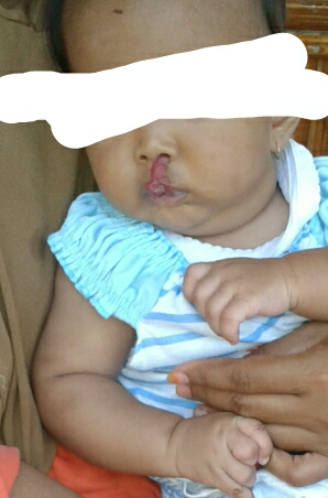 HELP. Pak Dokter Bu Dokter masuk bantu keponakan Ane :(
