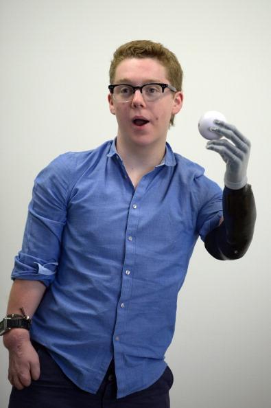 Keren gan!! Tangan buatan yang bisa menirukan gerakan menggenggam