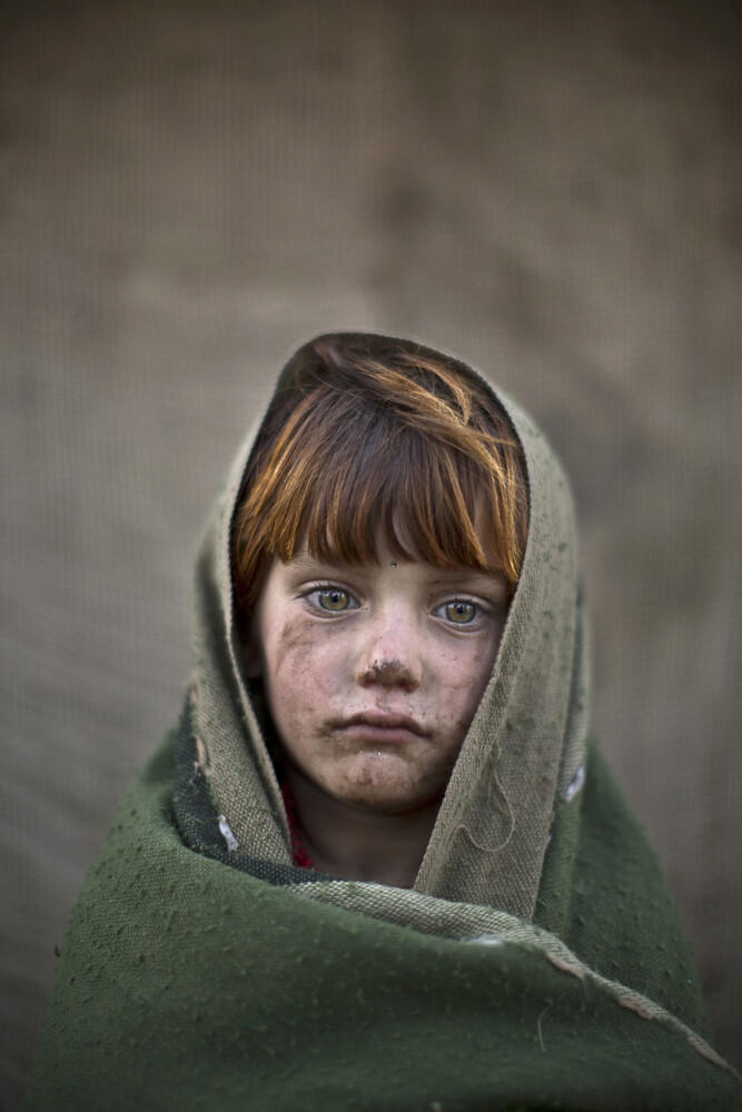 Potret Anak-Anak korban Peperangan dan Perselisihan di Afghanistan 