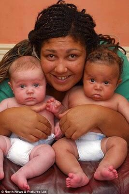 10 Bayi Aneh Yang Pernah Dilahirkan