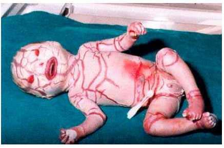 10 Bayi Aneh Yang Pernah Dilahirkan