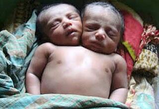 10 Bayi Aneh Yang Pernah Dilahirkan