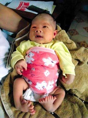 10 Bayi Aneh Yang Pernah Dilahirkan