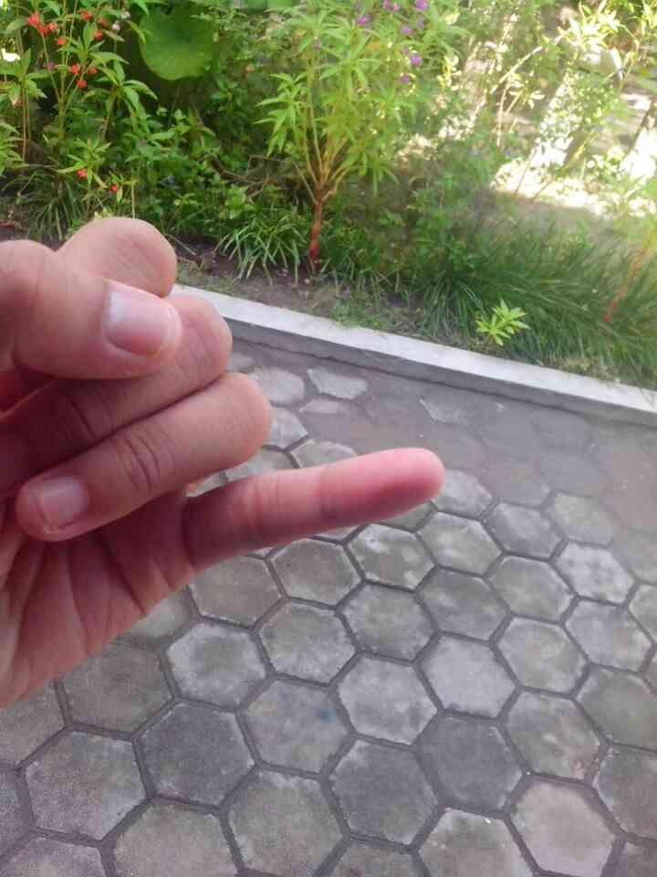 Cara menghilangkan tinta pemilu