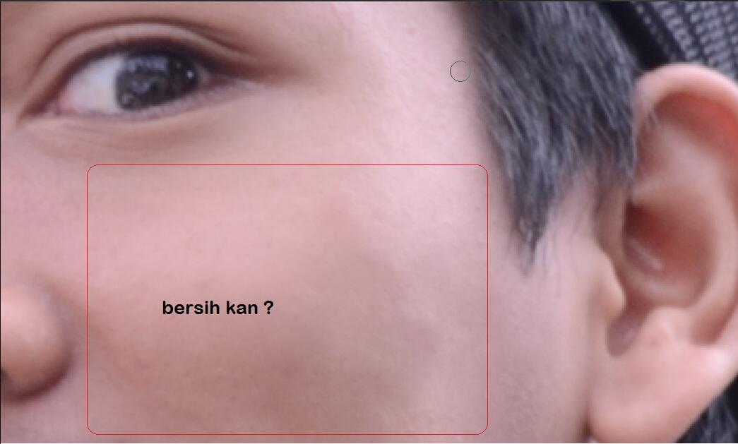 &#91;Tips&#93; membersihkan jerawat di foto