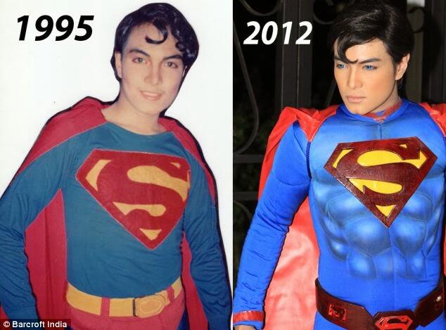 Rela Operasi Plastik Puluhan Kali Demi Mirip Superman