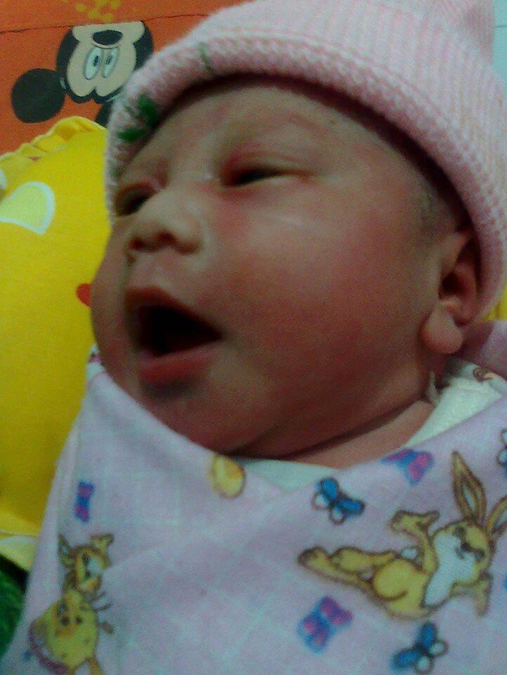 &#91;ASK&#93; Penyakit Jantung Bawaan pada Bayi