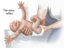 Uniknya Refleks Primitif Pada Bayi (Picture)