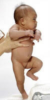 Uniknya Refleks Primitif Pada Bayi (Picture)