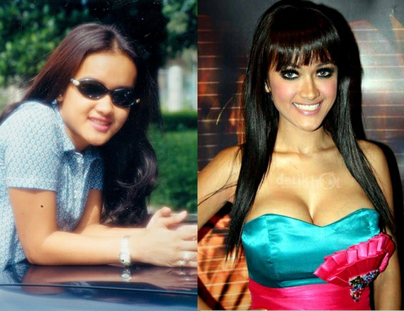Perbedaan Payudara Artis Sebelum dan Setelah Terkenal