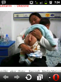 Bayi Asal China Memiliki Ekor
Lima Inci
