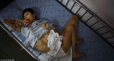 Terungkap! Anak-Anak Korban Senjata Kimia 40 Tahun Silam