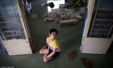 Terungkap! Anak-Anak Korban Senjata Kimia 40 Tahun Silam