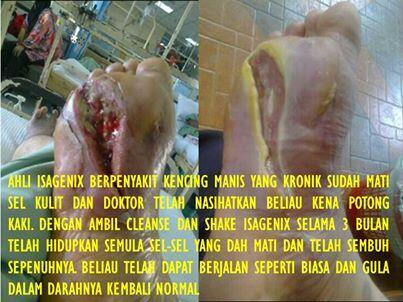 BISNIS ISAGENIX - PELUANG SUKSES UNTUK MANTAN DIST MLM MANAPUN