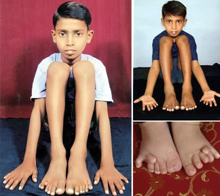 Orang-orang punya bagian tubuh paling ajaib di Dunia. ASLI Gans no SOTO!