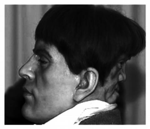 Edward Mordrake &quot;Si Muka Dua&quot;