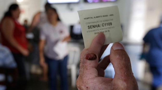 Penduduk Desa di Brasil `Meleleh` Jika Kena Sinar Matahari
