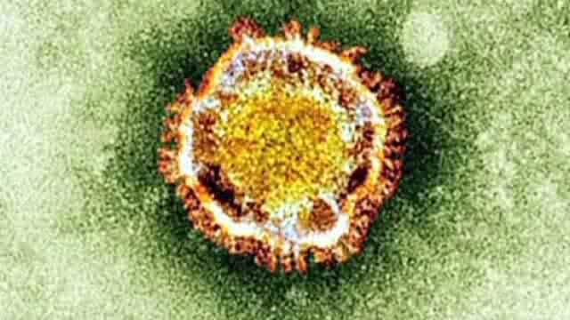 Cara Mencegah Penularan Virus MERS-CoV(Middle East Respiratory Syndrome-Corona Virus)