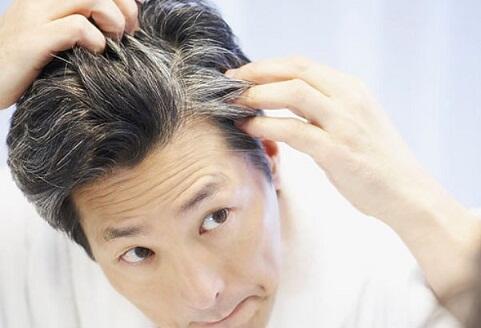 8 Bahan Alami untuk Melawan Rambut Beruban