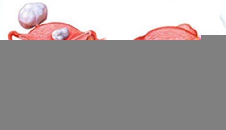 Khusus wanita (Sis wajib masuk !!!!)