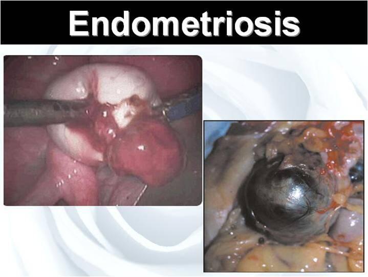 Khusus wanita (Sis wajib masuk !!!!)