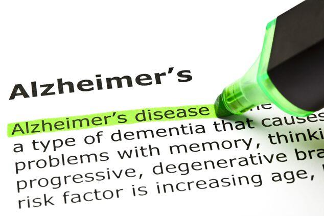 Puasa dua kali dalam seminggu bisa mencegah penyakit Alzheimer