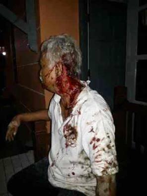 Korban Penyerangan di Sleman Mengaku Diselamatkan Intelijen