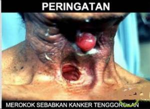 MOBIL bikin lobang di jalanan // ROKOK bikin lobang di tenggorokan!! AWAS