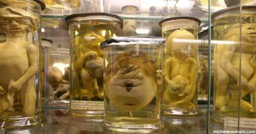 Mengenal lebih dekat museum Dupuytren (buat yang berani)