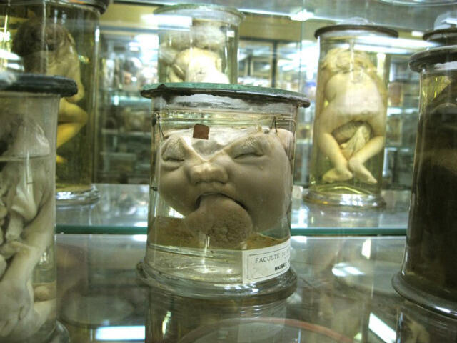 Mengenal lebih dekat museum Dupuytren (buat yang berani)