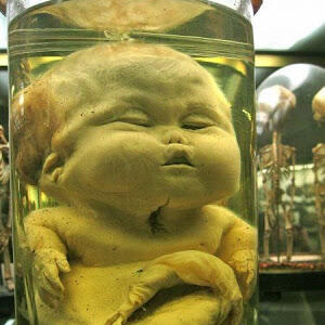 Mengenal lebih dekat museum Dupuytren (buat yang berani)