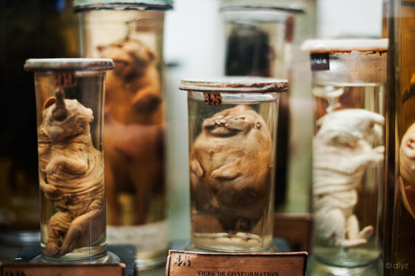 Mengenal lebih dekat museum Dupuytren (buat yang berani)