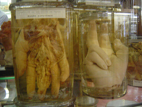 Mengenal lebih dekat museum Dupuytren (buat yang berani)