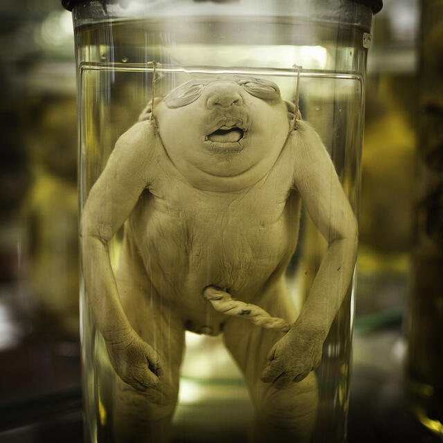 Mengenal lebih dekat museum Dupuytren (buat yang berani)