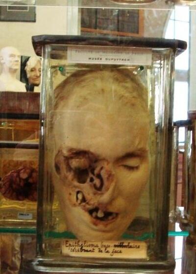 Mengenal lebih dekat museum Dupuytren (buat yang berani)