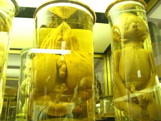 Mengenal lebih dekat museum Dupuytren (buat yang berani)